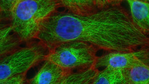 Atomik Ölçekte Görüntüleme Gerçek Oldu