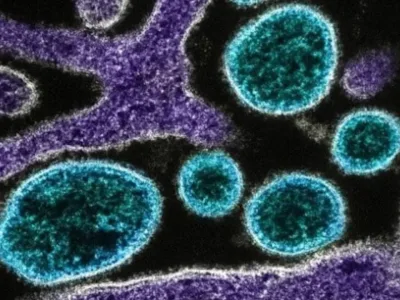 DSÖ, İlk İnsan Shamonda Virüsü Vakasını Araştırıyor
