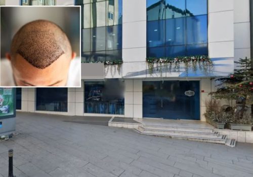 İngiliz turist saç ekimi sonrası hayatını kaybetti