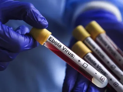 Kongo'da Ebola Bilançosu Ağırlaşıyor