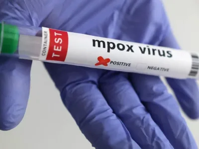 Maymun Çiçeği Virüsü Evrim Geçiriyor