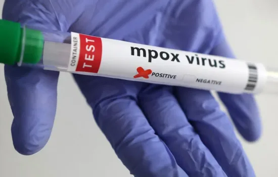 Maymun Çiçeği Virüsü Evrim Geçiriyor