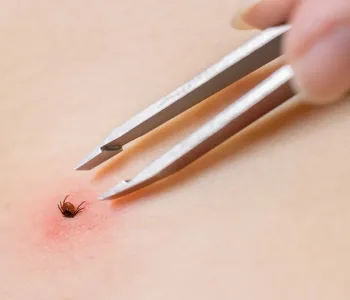 Yağışlı Kış Kene Sayısını Artırabilir